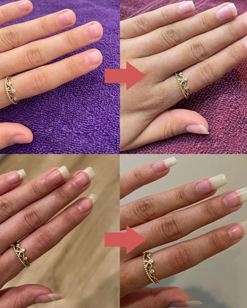 Nagels voedzame groeiolie